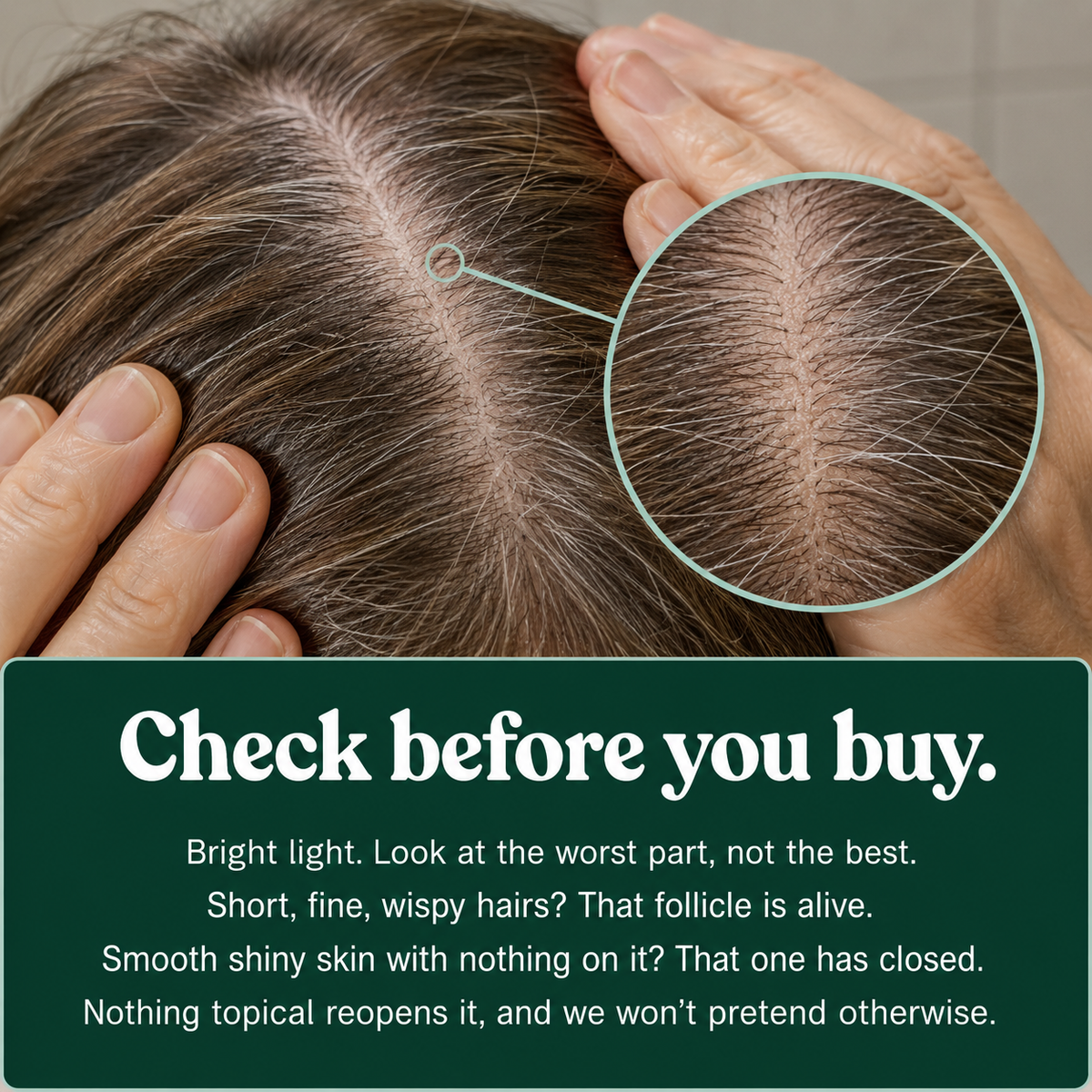 Scalp Activation Serum