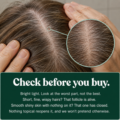 Scalp Activation Serum
