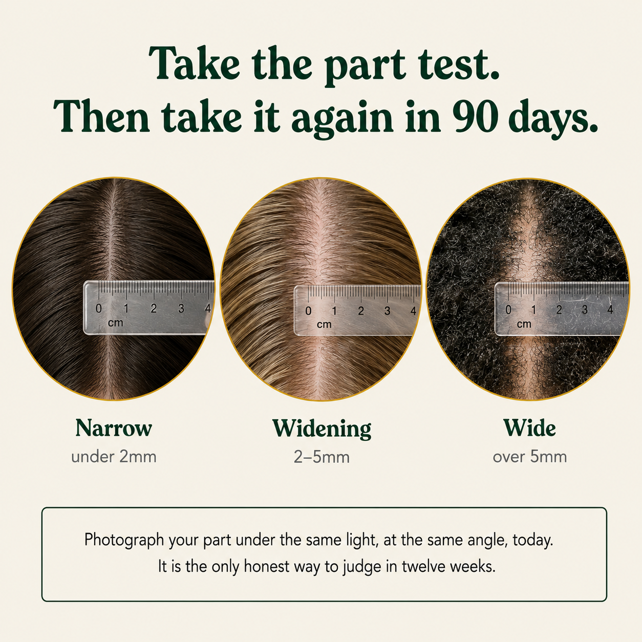 Scalp Activation Serum — Rosemary + Green Tea & Vitamin E