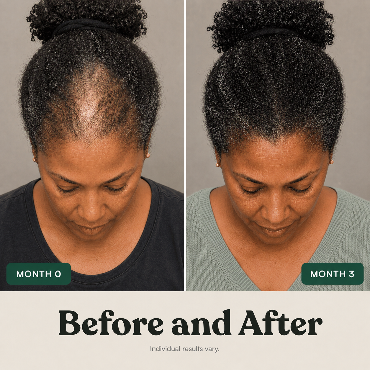 Scalp Activation Serum — Rosemary + Green Tea & Vitamin E